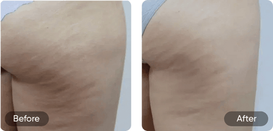 Before and after comparison